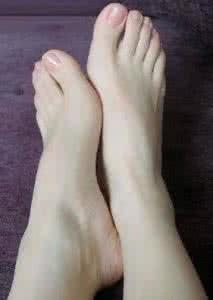 脚上冻疮 除脚上的坏死老皮、老茧、冻疮脚癣的妙方
