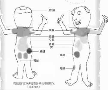 生长性疼痛 专家解析 什么是“生长疼痛”