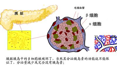 长期使用胰岛素的危害 胰岛素的副作用 长期使用胰岛素治疗糖尿病的副作用与危害