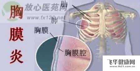 胸膜炎的病因 胸膜炎严重吗 胸膜炎病因及治疗