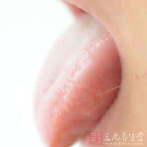 舌头中间有一条裂纹 舌头中间有一条裂纹 舌面中间有裂纹的特点及原因