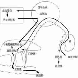 黄疸性肝炎怎么治疗 黄疸性肝炎怎么治疗 黄疸肝炎怎么治疗好