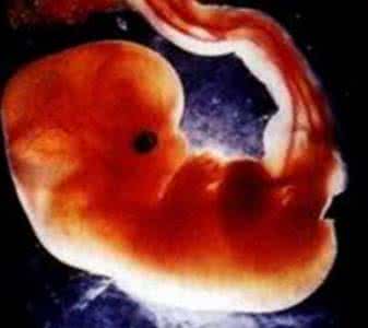 死胎有什么症状 死胎有什么症状 预防死胎的方法有哪些