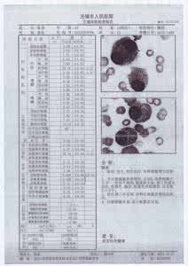 多发性骨髓瘤治疗方法 疾病预防 多发性骨髓瘤 多发性骨髓瘤有哪些治疗方法