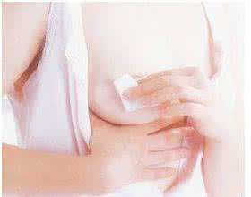 如何预防乳头皲裂 乳头皲裂怎么办 预防乳头皲裂的方法