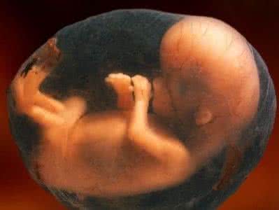 造成胎儿缺氧的原因 胎儿缺氧 造成胎儿缺氧的原因