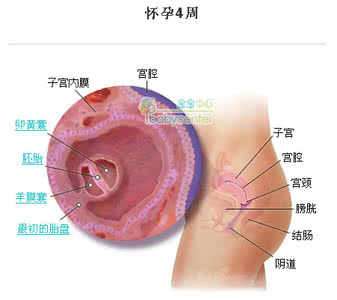 孕早期羊水会破吗 孕早期破羊水的原因？