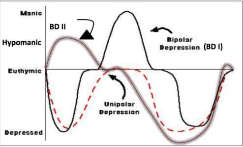 双向情感障碍 关于情感障碍（Affective Disorder)