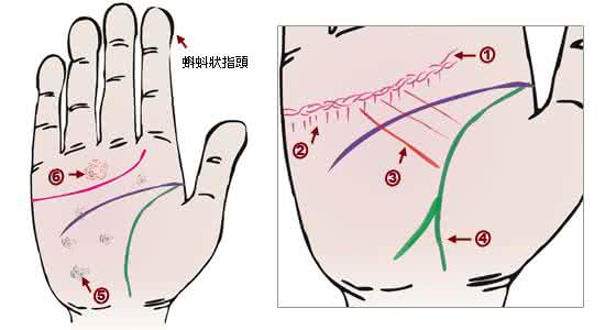 通过手相看疾病 24种手相揭示疾病征兆_腾讯新闻