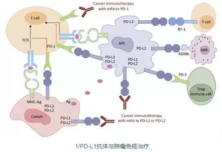 pd l1检测 pd l1是什么 PD-L1是怎么检测的？