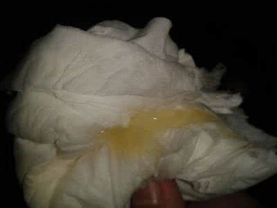 羊水破了是什么图片 羊水破了是什么颜色