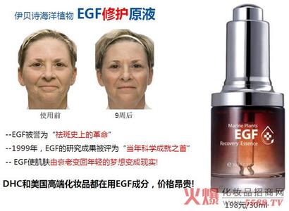 egf修复原液 egf修复原液 脸上长痘痘怎么办 祛痘修复圣品EGF原液帮你搞定