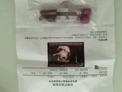 贾静雯生下第三胎 三胎验血终于如愿男宝 产妇如愿生下健康男宝,让在场医生感触很大