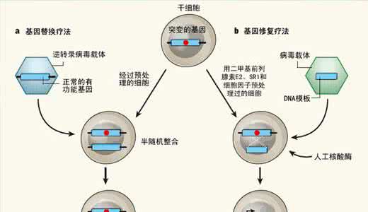多基因遗传病病因 多基因遗传病病因 牛皮癣的病因与遗传因素 病程