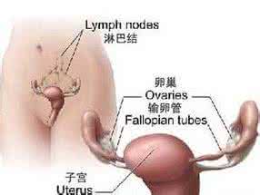 卵巢肿瘤多大是恶性的 卵巢恶性肿瘤一般多大 及时发现一般性卵巢肿瘤