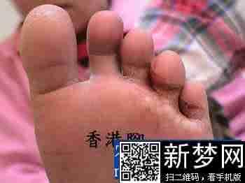 有脚气脚臭怎么办 脚气脚臭怎么办 脚气有哪些危害