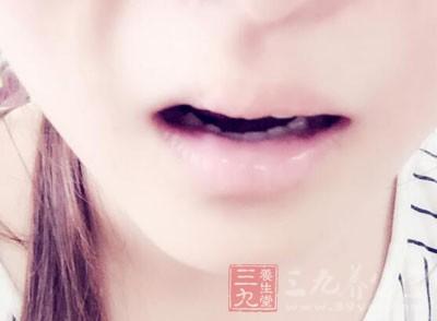 厌氧菌口臭怎么根治 厌氧菌口臭怎么得的？