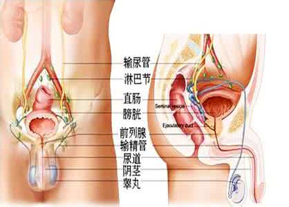 泌尿系结石治疗方法 泌尿系结石 如何治疗泌尿系结石