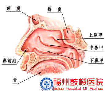 干燥性鼻窦炎的偏方方 干燥性鼻炎 它是怎样造成的