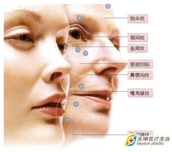 botox肉毒素 botox肉毒素 Botox肉毒素的效果如何