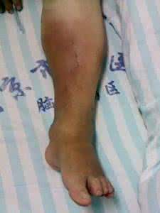 血脉喷张 她已经又红又肿，我却还血脉喷张