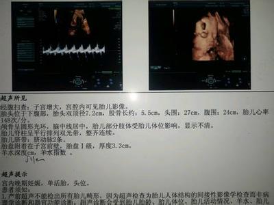 b超女宝 生下来是男宝 【 4大生男生女计算公式 男宝女宝一算就知道了】(20140712)