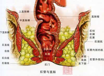 直肠炎症状及治疗 直肠炎是怎么引起的 直肠炎的症状与治疗