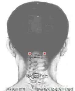 脑溢血能治好吗 眼点穴治脑溢血后的复原