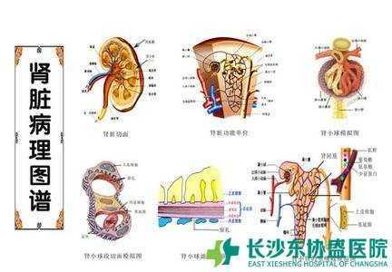 肾盂肾炎和肾小球肾炎 图文：治疗肾小球肾炎与肾盂肾炎黄金搭配方案