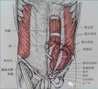 腹外斜肌损伤 腹外斜肌损伤的针刀治疗