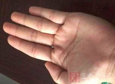 手心脚心出汗 手心脚心出汗是怎么回事 教你预防手脚出汗