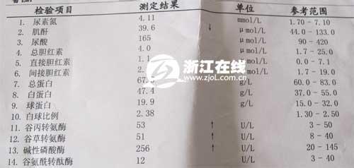 新生儿黄疸肝功能指标 新生儿肝功能指标