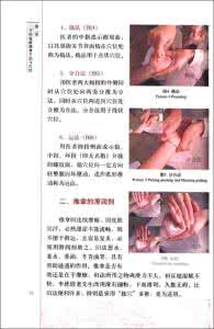 小儿按摩培训班 小儿按摩改进版本