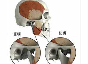 治疗下巴脱臼的好方法 下巴脱臼治疗 下巴脱臼 治疗下巴脱臼的小方法