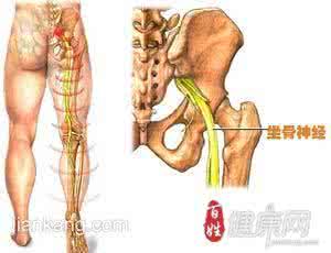 针灸治疗坐骨神经痛 此针灸法在10分钟内能治愈坐骨神经痛