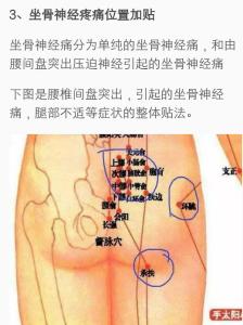 左边腰疼是怎么回事 屁股左边疼怎么回事？