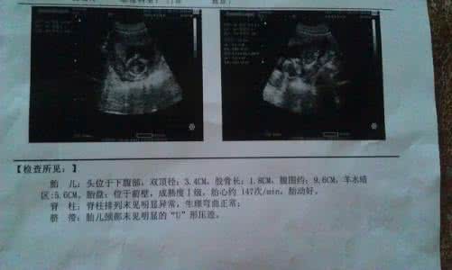 怀孕什么时候做b超 孕中期B超什么时候做