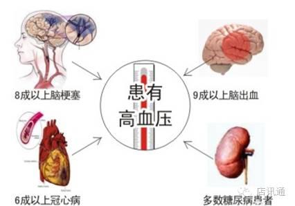 高血压早期症状 需知:高血压的早期症状