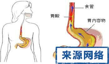 胃酸反流吃什么食物好 胃酸反流吃什么好？