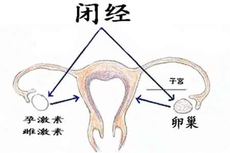 治闭经的偏方 闭经的危害
