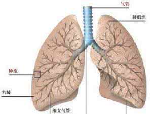 肺气肿晚期死亡症状 肺气肿症状 肺气肿的临床表现是什么