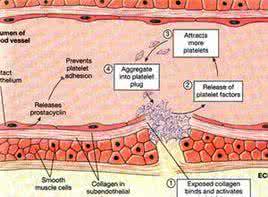 血小板减少和压积低 血小板低的原因 认识血小板减少病症