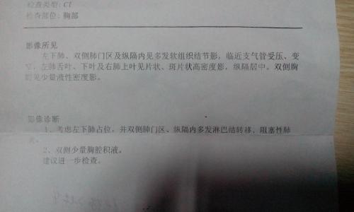 脑肿瘤治疗简史 肺癌晚期怎么治疗 肺癌治疗简史