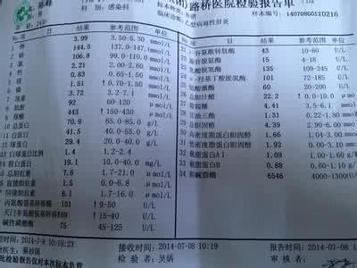 转氨酶高的治疗方法 转氨酶高的治疗方法 这样可以治疗转氨酶高