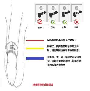 增加硬度的方法 阴茎勃起增加硬度的方法有哪些