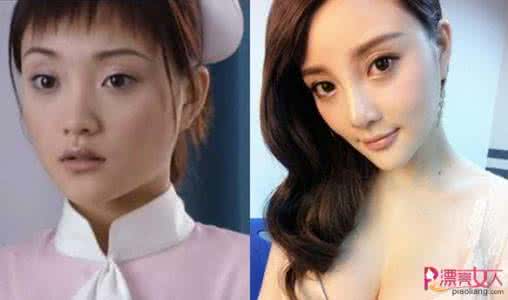 李小璐整容前后照片 李小璐整容前后照片 盘点李小璐十年整容路，排毒养颜让你自然变美丽！