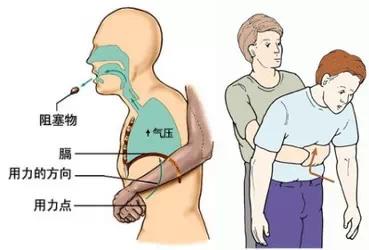 喉咙有鱼刺如何处理 鱼刺卡喉咙的处理方法 鱼刺卡喉咙的急救方法