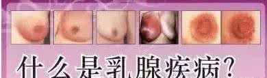 乳腺癌 泪流满面 乳腺 癌10大前奏 看完泪流满面！