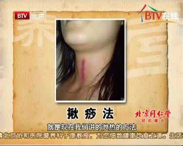 杨金生 专辑: 杨金生《刮板不离手健康跟着走》3全集