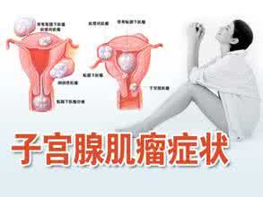 子宫肌瘤症状有哪些 子宫肌瘤症状 得了子宫肌瘤能跳广场舞吗